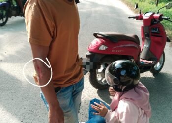 Tak Kunjung Diperbaiki, Akses Jalan Kantor Bupati Batu Bara Telan Korban