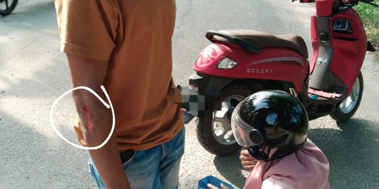 Tak Kunjung Diperbaiki, Akses Jalan Kantor Bupati Batu Bara Telan Korban